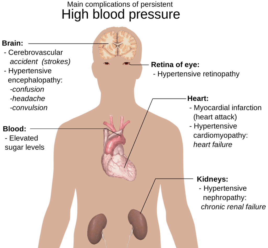 Health Risks With Obesity Belly Fat The Battle Of The Bulge health-risks-with-obesity-belly-fat-the-battle-of-the-bulge
